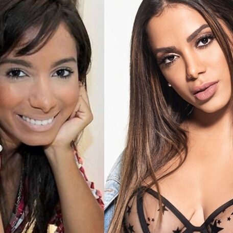 Anitta Antes E Depois Veja Transformacoes Da Cantora V X PODER AO POVO