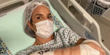 IVETE SANGALO PASSA POR CIRURGIA NO BRAÇO
